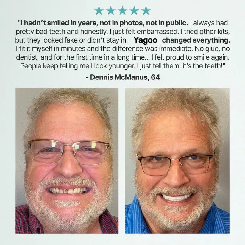 🌎Ends Today: 70% OFF! ⏰meleval® Medical Full Denture with Strong Suctiond🦷Obtain American Dental Association (ADA) Certification