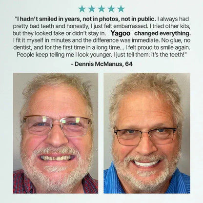 🌎Ends Today: 70% OFF! ⏰meleval® Medical Full Denture with Strong Suctiond🦷Obtain American Dental Association (ADA) Certification