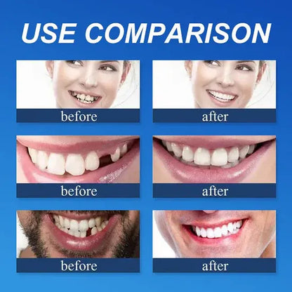 🌎Ends Today: 70% OFF! ⏰meleval® Medical Full Denture with Strong Suctiond🦷Obtain American Dental Association (ADA) Certification